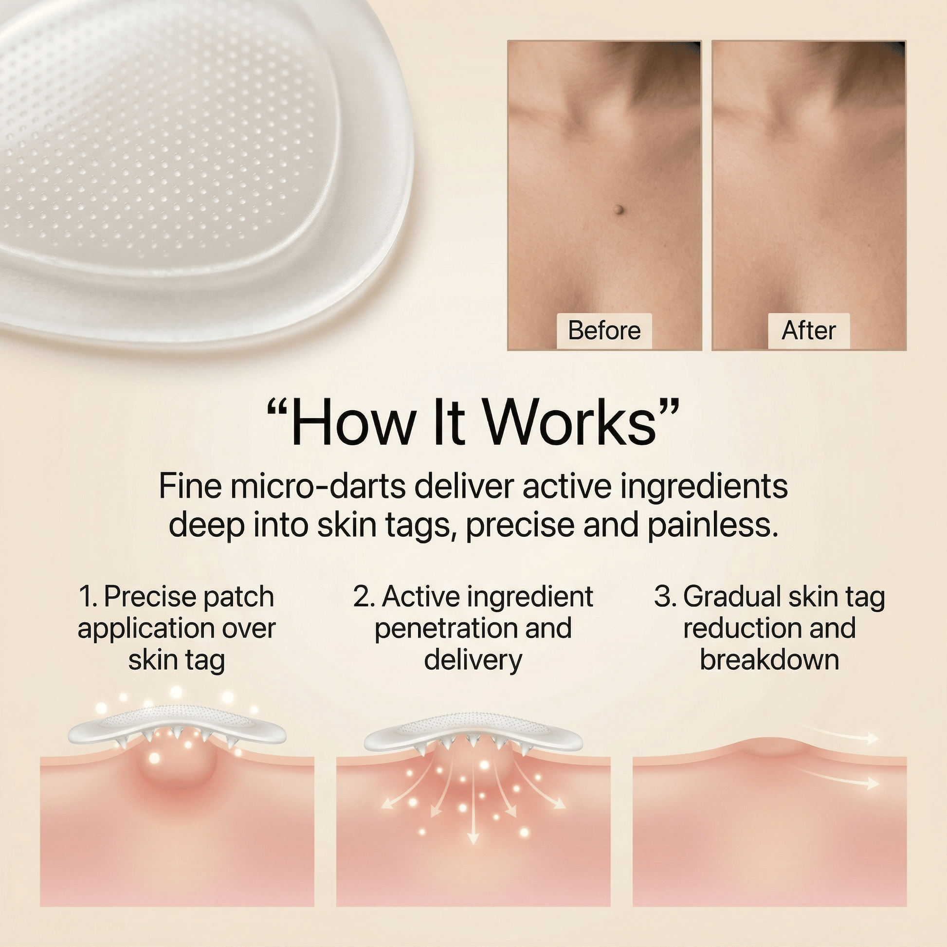 DermaSmooth - Tag Remover