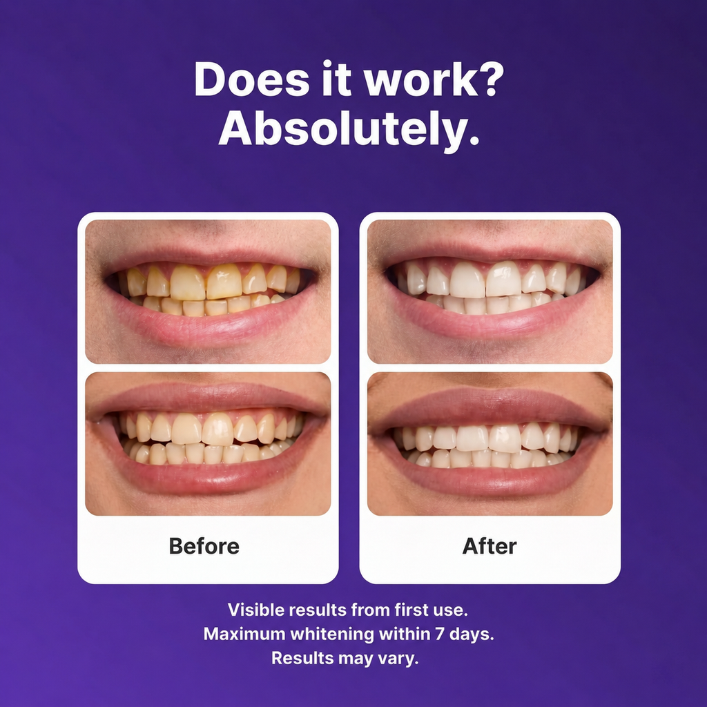 Pure Pearl - ProTeeth Whitening Strips